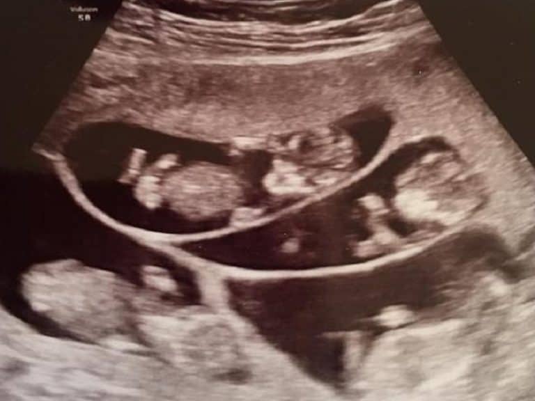 worlds first septuplets 01