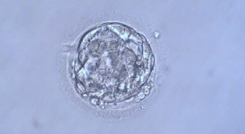 disturbing results extra embryos 01