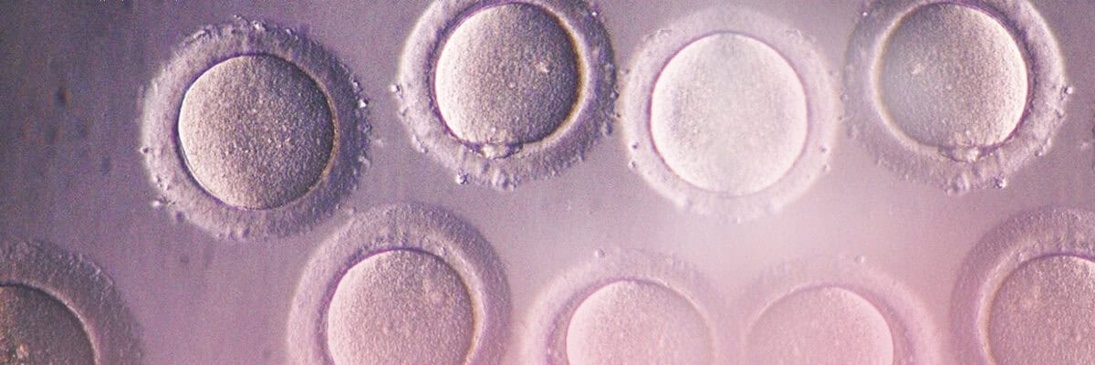 what you should know egg freezing 01